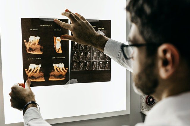 Man with beard wearing glasses viewing backlit dental X-rays